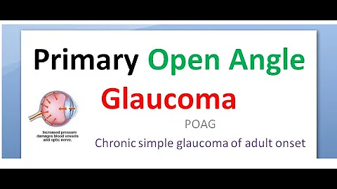 Ophthalmology 236 a Primary Open Angle Glaucoma PO...