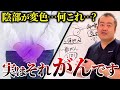 放置すると超危険!あまり知られていない外陰がんの情報を産婦人科医が解説!
