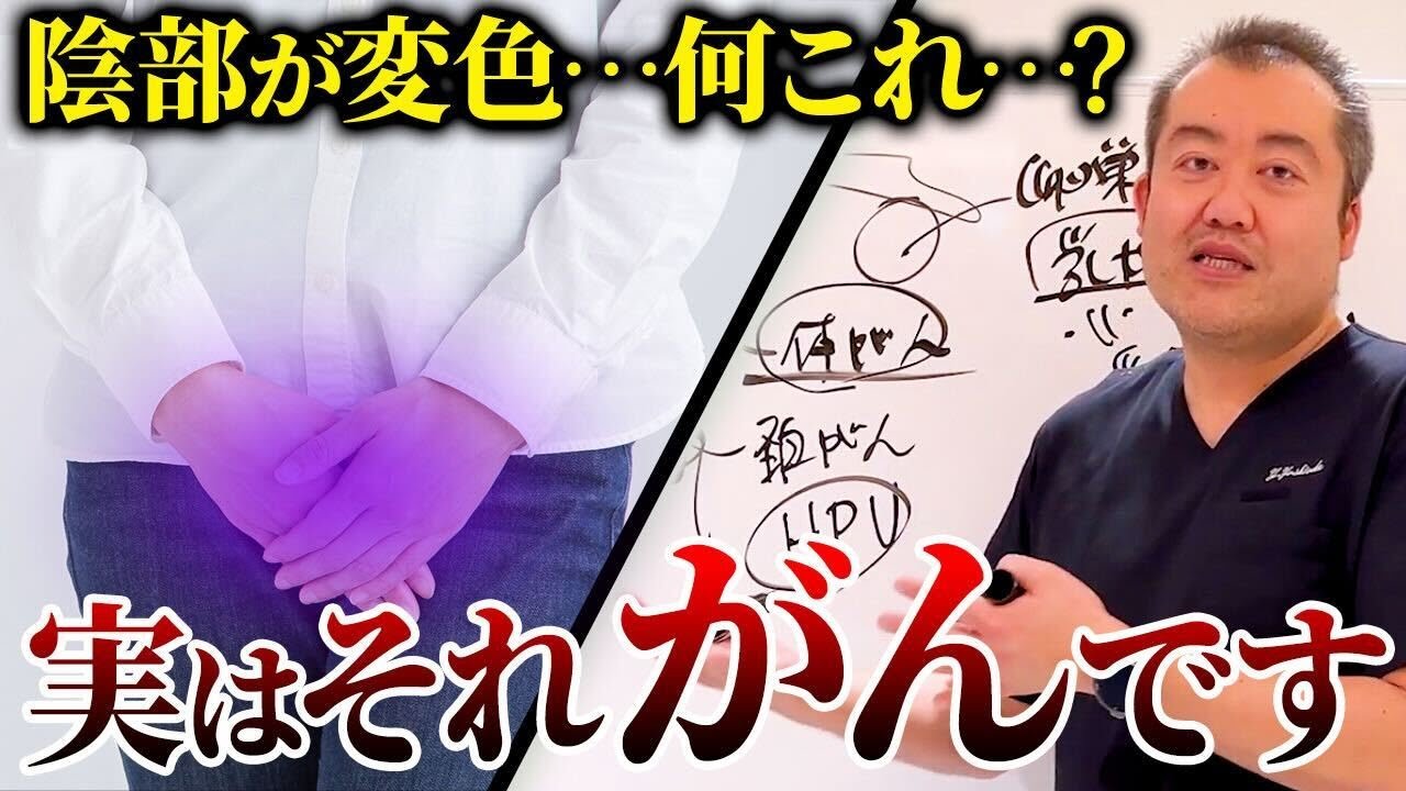 放置すると超危険！あまり知られていない外陰がんの情報を産婦人科医が解説！