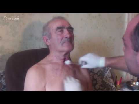 შვილმა მამას სახლში ოპერაცია გაუკეთა