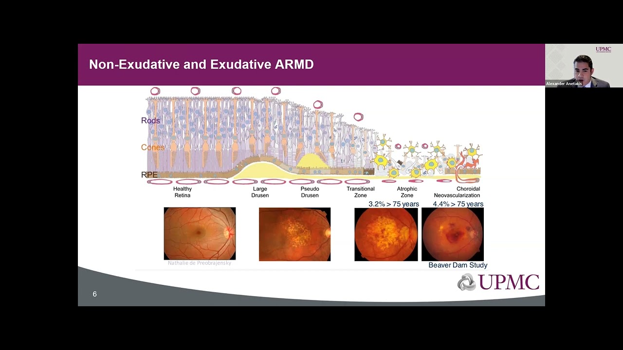 Sight + Sound Bites: AMD Understanding Genetic and Behavioral Risk ...