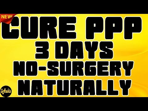 Pearly Penile Papules REMOVAL At Home Easy and Quickly - Get Rid Of PPP FOREVER In 3 Days!