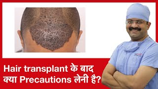 Top 7 Things to Avoid After Hair Transplant Procedure  Cyber Hairsure