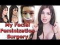 I'M BACK! My Facial Feminization Surgery
