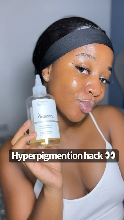 The best product for DARK SPOTS/ HYPERPIGMENTATION troubles! Works like a charm…GLYCOLIC ACID TONER✨