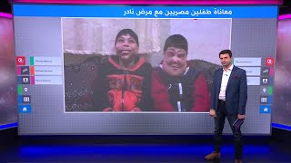 تعاطف كبير مع طفلين مصريين يعانيان من مرض 