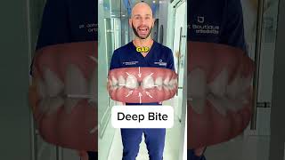 How can I fix my deep bite?