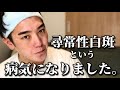 尋常性白斑という病気になりました。