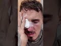 Tom Aspinall on gaining new respect for Michael Bisping after his eye injury vs Ciryl Gane 🤕