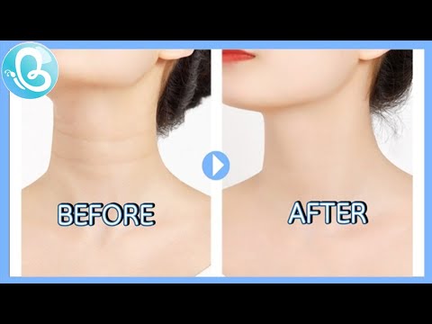 How to Get Rid of Neck Lines, Face Workout to rid of Neck Lines.