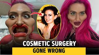 10 Celebrity Plastic Surgery Disasters | Then and now 2026