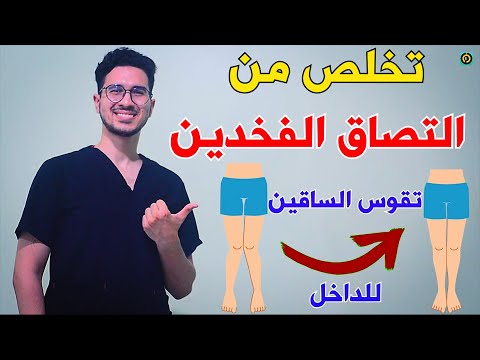 فيديو: كيفية إيقاف الالتصاق