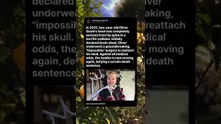 The Toddler Who Survived an Internal Decapitation