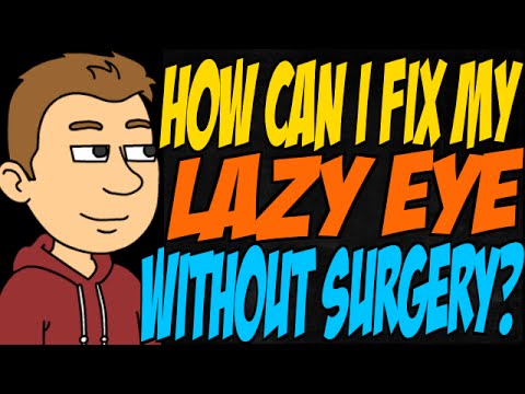 How Can I Fix My Lazy Eye Without Surgery? - YouTube