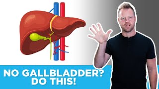 5 Things You Must Do If You Have No Gallbladder