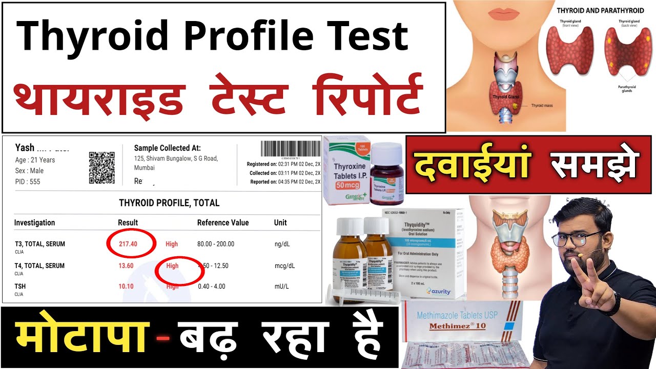 थायराइड रिपोर्ट | Thyroid Profile Test | Thyroid Test | T3 | T4 | TSH ...