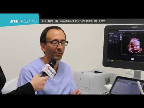 Video: Chi dovrebbe sottoporsi a una scansione della translucenza nucale?