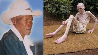 MAAJABU YA MZEE ALIYEBADILIKA NA KUWA KAMA MZUNGU |BLACK MAN TURNED WHITE