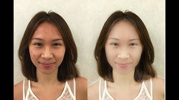 How to clean face and remove acne in Toolwiz Photos|Toolwiz pro editor