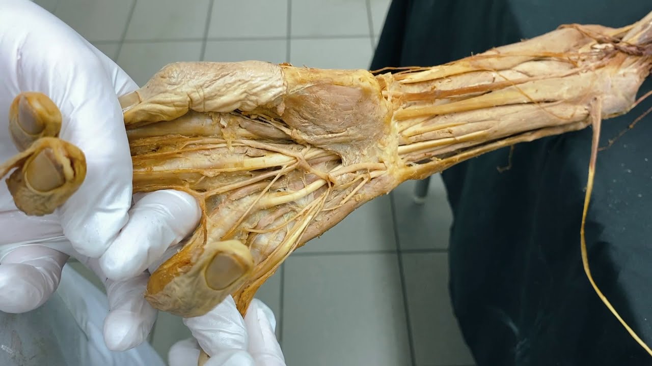 Nerven Arm - Plexus brachialis Teil II | Sezierkurs Live Anatomie Innsbruck