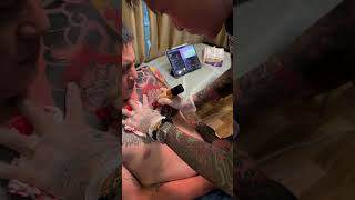 Xam đau không qui vị