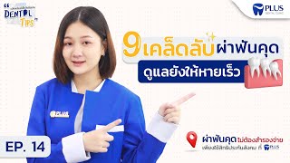 9 เคล็ดลับ เอาใจคนผ่าฟันคุด ดูแลยังไงให้หายเร็ว | Dental Tips EP. 14