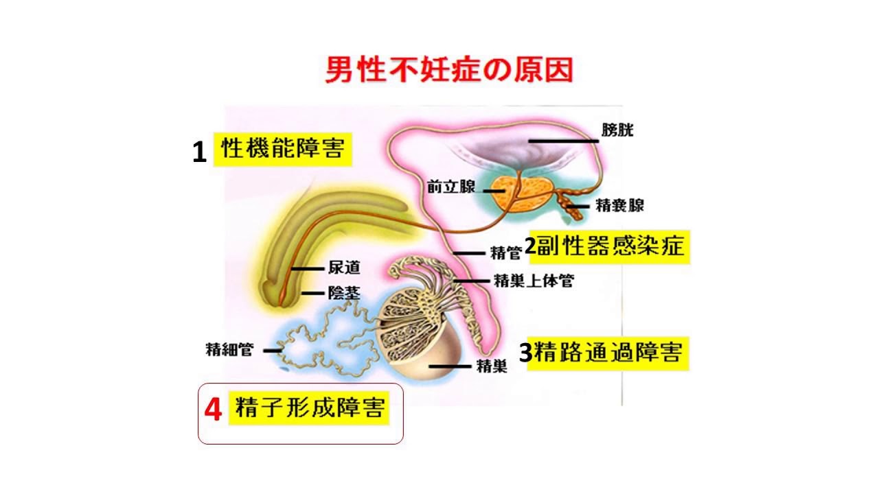 不妊または不妊の男性：違いと原因