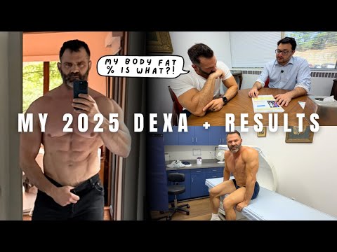 Body Composition Test My 2025 DEXA Scan Results Explained