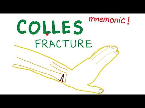 Colles Fracture Mnemonic