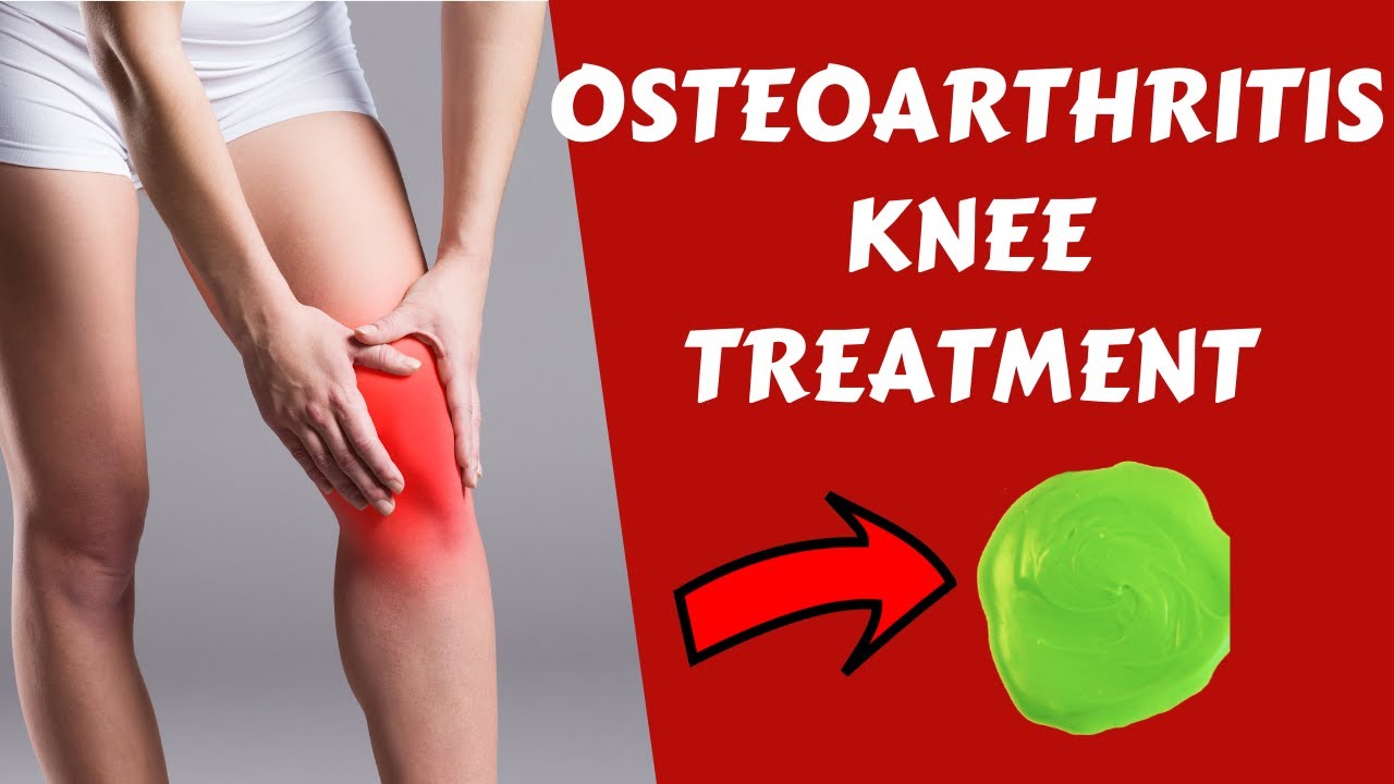 Osteoarthritis Treatment Knee Osteoarthritis Knee Osteoarthritis