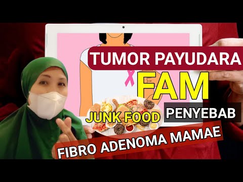 Video: Bagaimana merawat fibroadenoma payudara dan apa itu