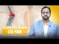 Can Spine Problems Cause Leg Pain? Explained Clearly | #LegPain #Sciatica #spinehealth