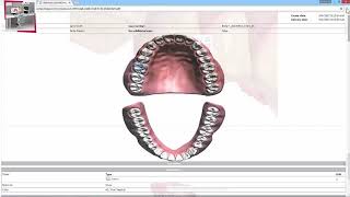 3Shape Communicate - 3Shape Communicate を使って歯科医院と技工所間でコミュニケーションをとる方法