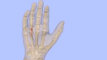 Trigger Finger Release