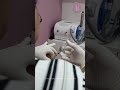 Liquid Rhinoplasty at Pinkappple Aesthetics: Before and After | Nose Surgery | Nose