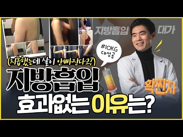 지방흡입 사고 발생하는 3가지 이유 | 왜 지방흡입에 사고가 나는 걸까?