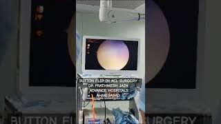 Ecobutton flex ACL surgery .world first hybrid loop technique for ACL