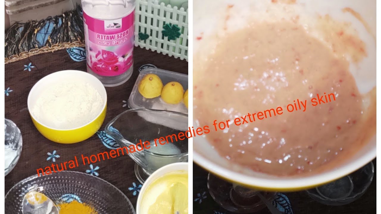 Natural home remedy for oily skin/Anti pimple,anti scars face mask