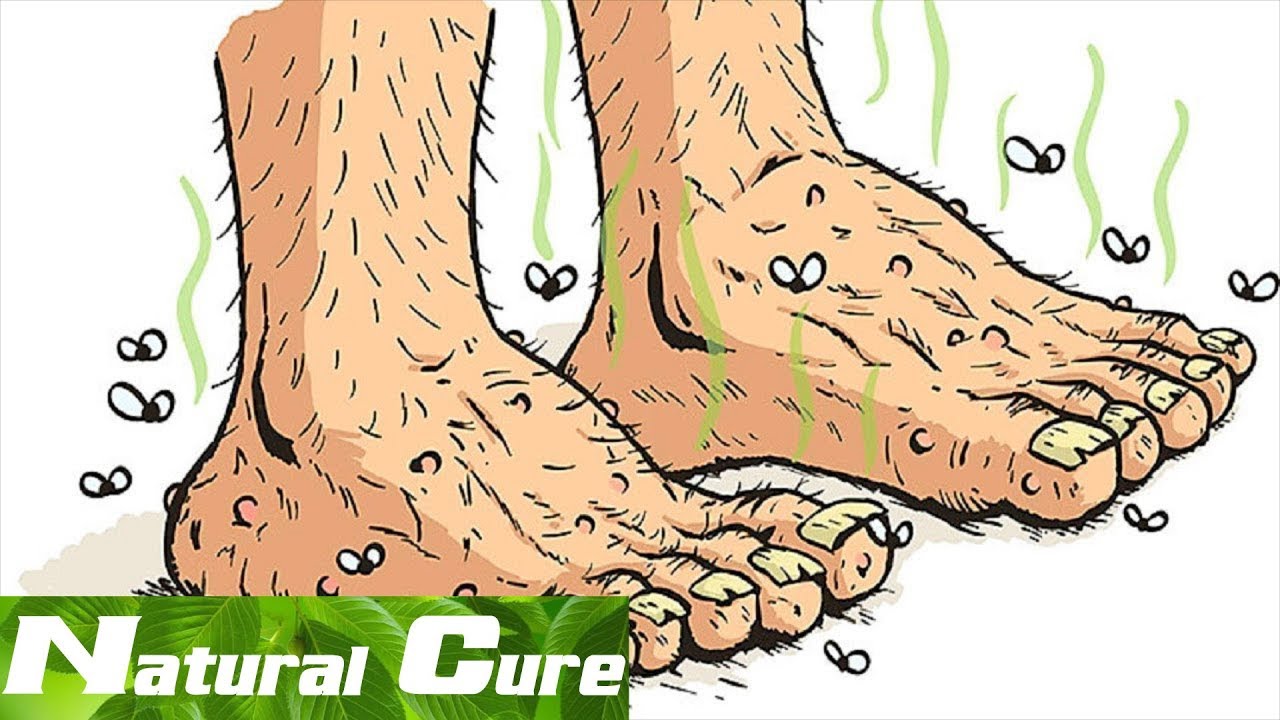 Natural Cure A Surefire Way To Get Rid Of Stinky Feet Fast YouTube