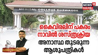 Pothuvedhi | കൈവിരലിന് പകരം നാവിൽ ശസ്ത്രക്രിയ | Kozhikode Medical College