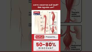 #shorts  Is Aortic Aneurysm serious? Dr.Giridhar Hariprasad @MedPlusONETV