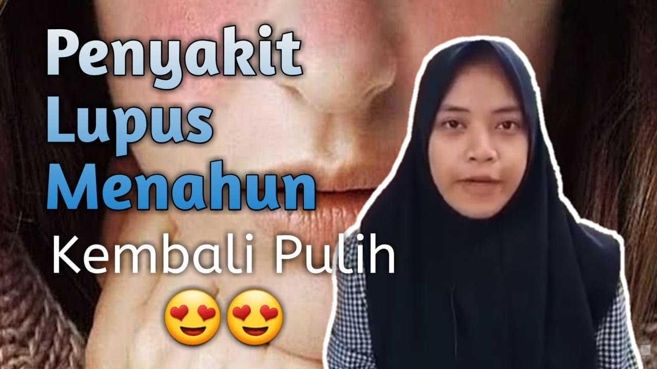 🔴 Cara Mengatasi dan Mengobati Penyakit Lupus Menahun 