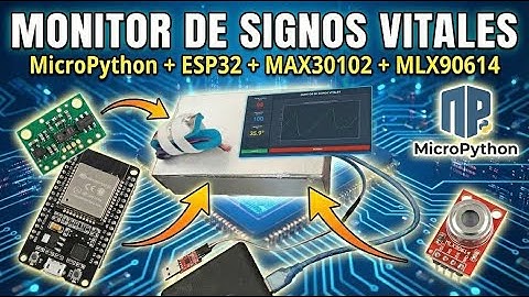 Monitor de Signos Vitales con ESP32 y MicroPython