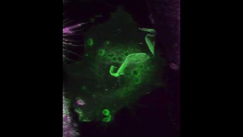 Lipopolysaccharide (LPS) Stimulation