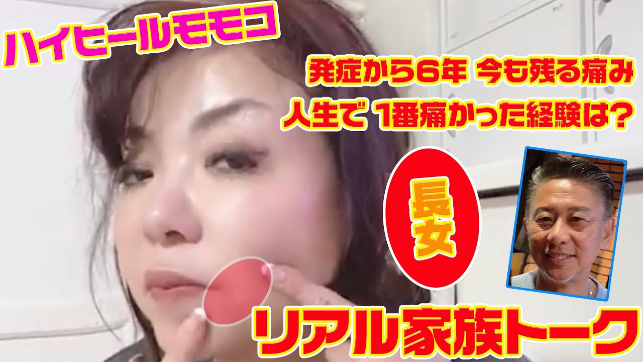 モモコ 帯状 疱疹 画像