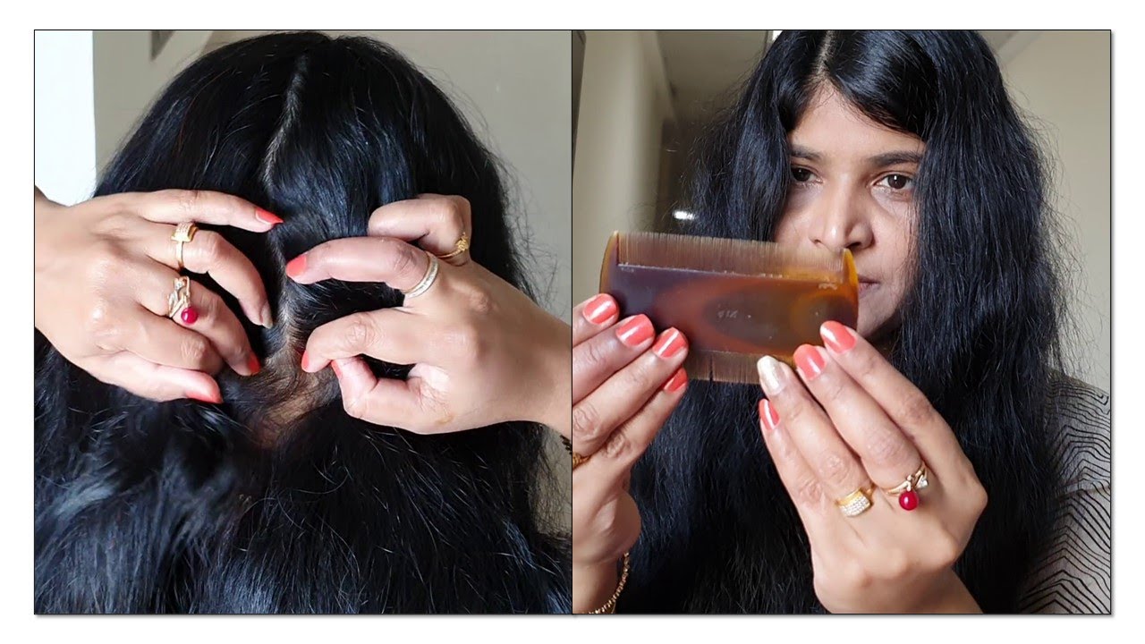 Traditional Self Head Lice Picking, Nitpicking, and Combing My Long Hair