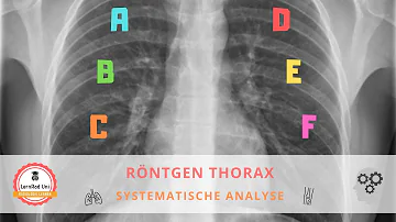 Wie lange dauert ein Thorax Röntgen?