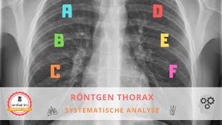Systematische Bildanalyse eines Röntgen Thorax