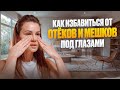 Отёки, синяки и мешки под глазами — как убрать своими руками | Массаж лица СМОЖЕТ КАЖДАЯ