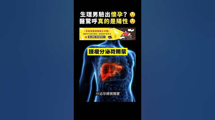 生理男驗出懷孕？😲醫驚呼真的是陽性😲｜志祺七七 #shorts